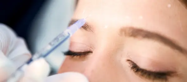 qd skinnovations botox 1