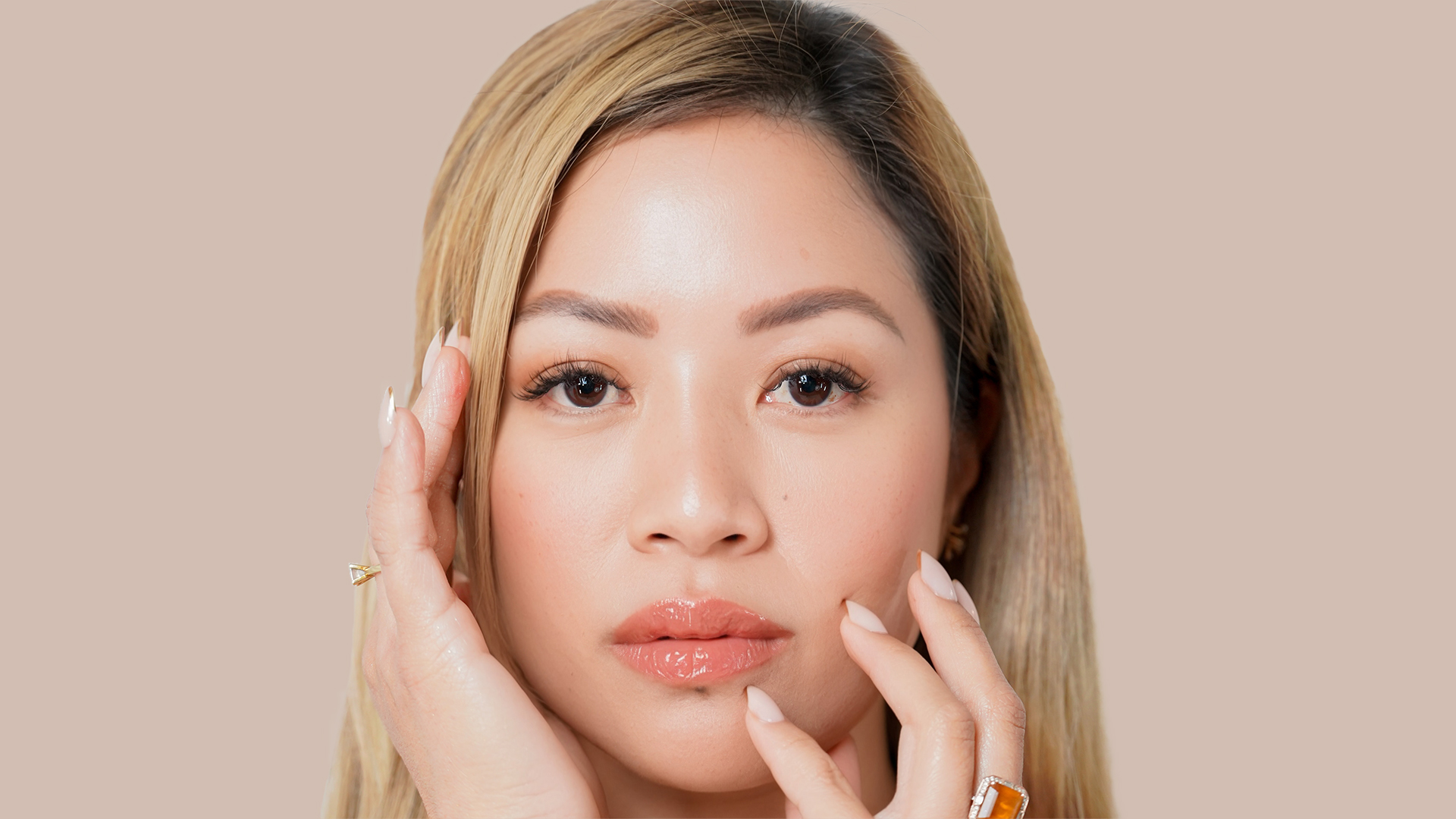 qd skinnovations botox banner