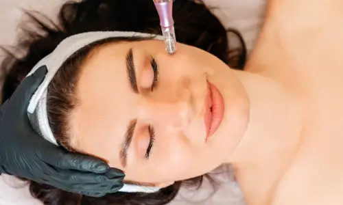 Microneedling with Exosomes The Future of Skin Rejuvenation