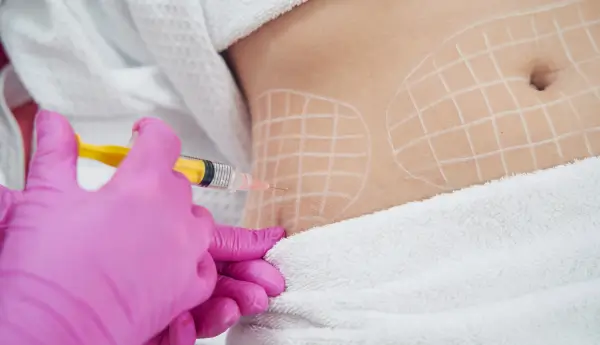 qd skinnovations mesolipo 1