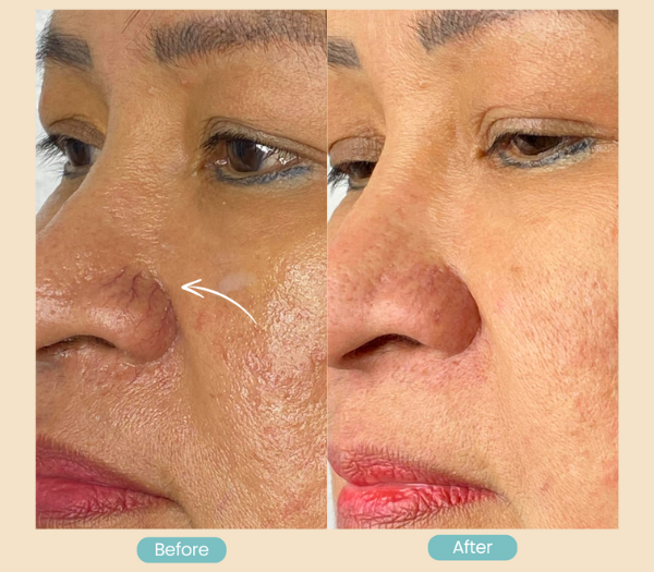 skin classic results - qd skinnovations