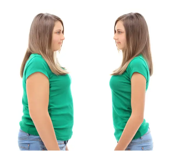 weight loss - ozempic